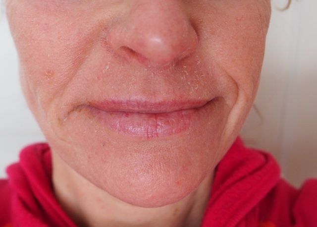 Dette virker mot rynker! Men...