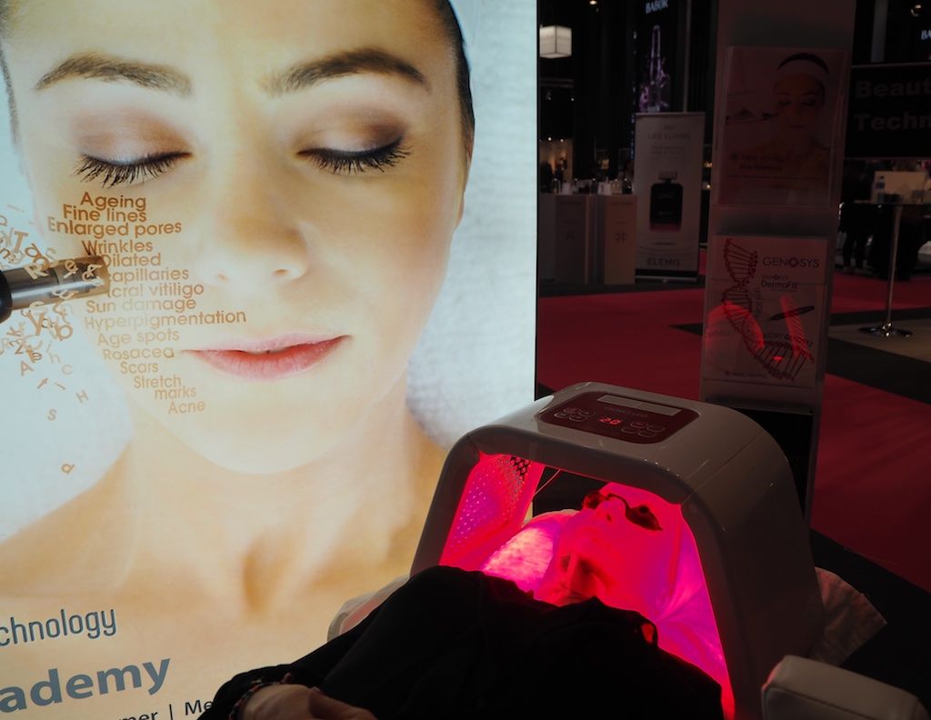 Jeg tester Mesoterapi - for fyldigere hud