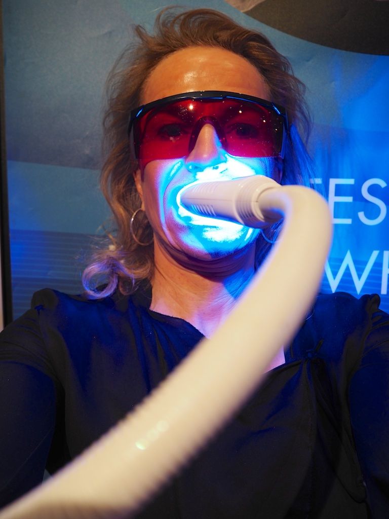 ÅTTE shades of white - Jeg testet tannbleking!