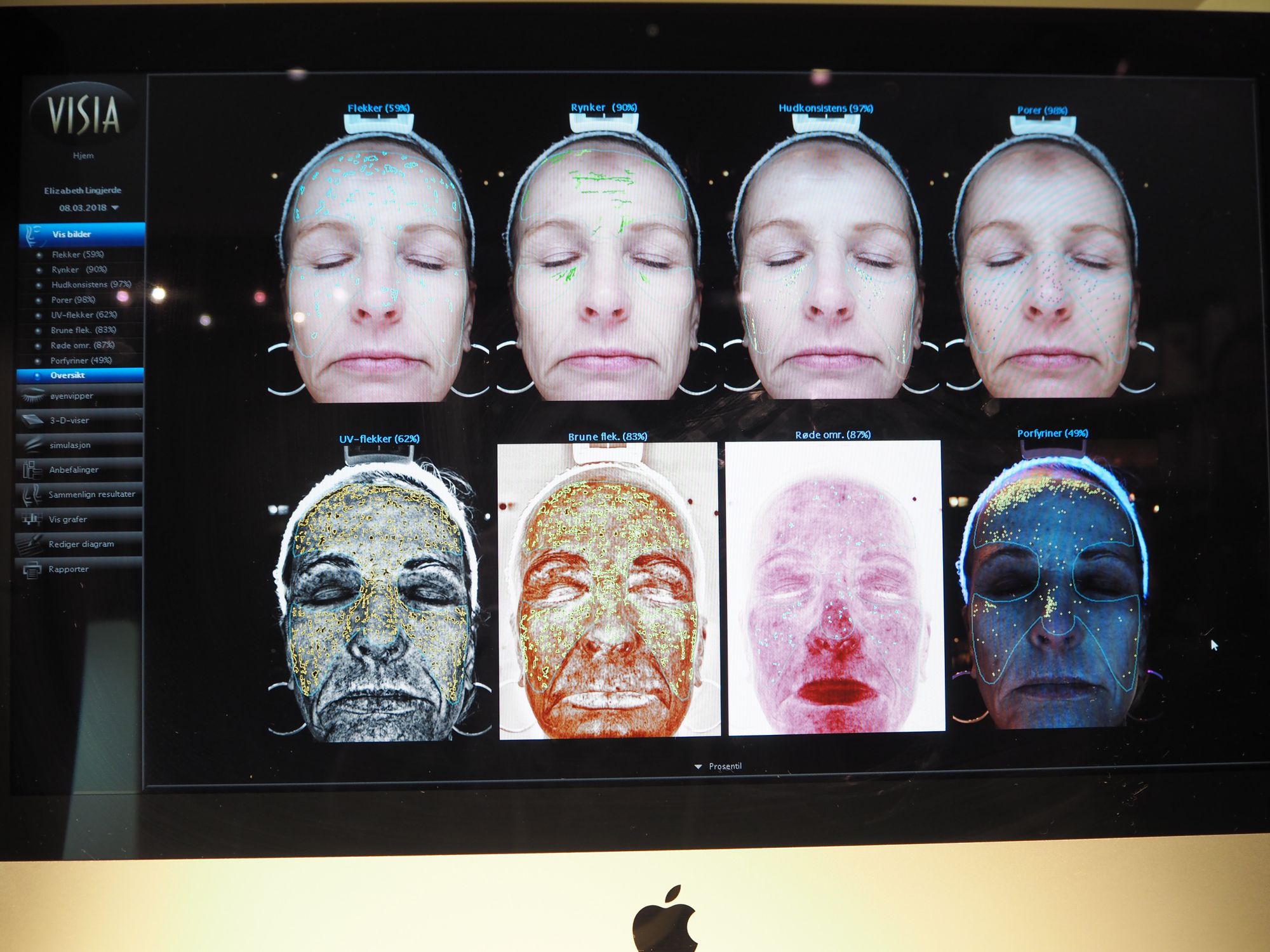 Ansiktsanalyse, og kan slapp magehud fikses uten kniv?